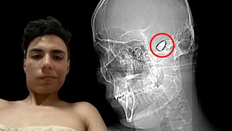 Kafasında Patlayıcı Var: Psikolojik Savaşın Korkutucu Yüzü